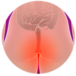 simplified image of the bottom - red area marks the position of haemmorrhoids